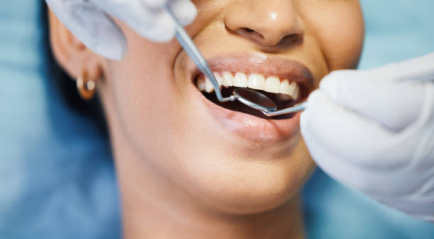 Best Broken or Cracked Tooth Emergency Dentist in Houston, TX