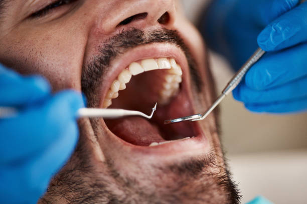 Best Mobile Emergency Dentist in Houston, TX