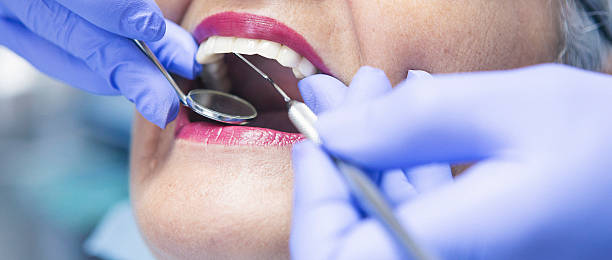 Best Emergency Dental Care for Abscessed Tooth in Houston, TX