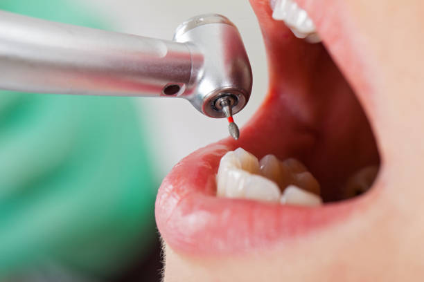 Best Emergency Dental Services for Seniors in Houston, TX